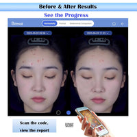 Analyseur de Peau Professionnel™